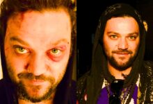 What Is The Current Status Of Bam Margera?