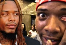 Fetty Wap Eye Story: The Childhood Accident Aftermath